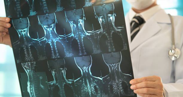 Doctor examining cervical spine MRI scans for spondylosis treatment