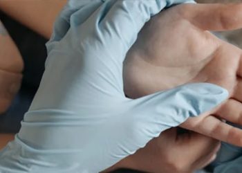 Medical professional examining a patient’s hand with a blue glove