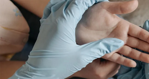 Medical professional examining a patient’s hand with a blue glove