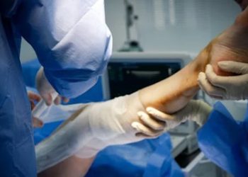 Treatment of a Broken Leg