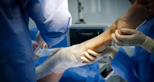 Treatment of a Broken Leg