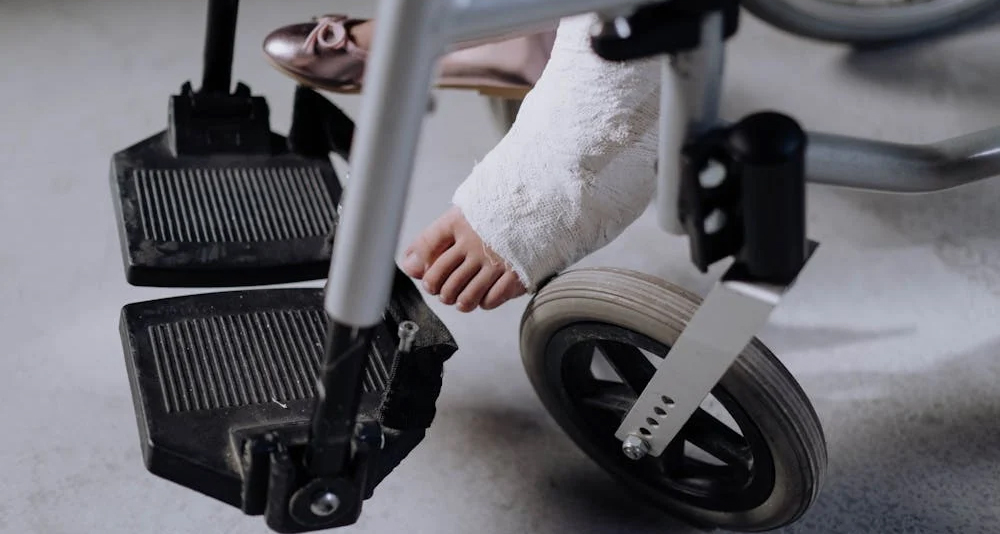 Foot in cast resting on a wheelchair footrest after toe fracture treatment