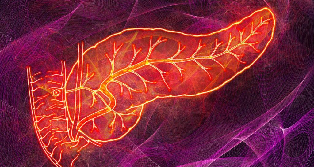 Understanding Idiopathic Pancreatitis
