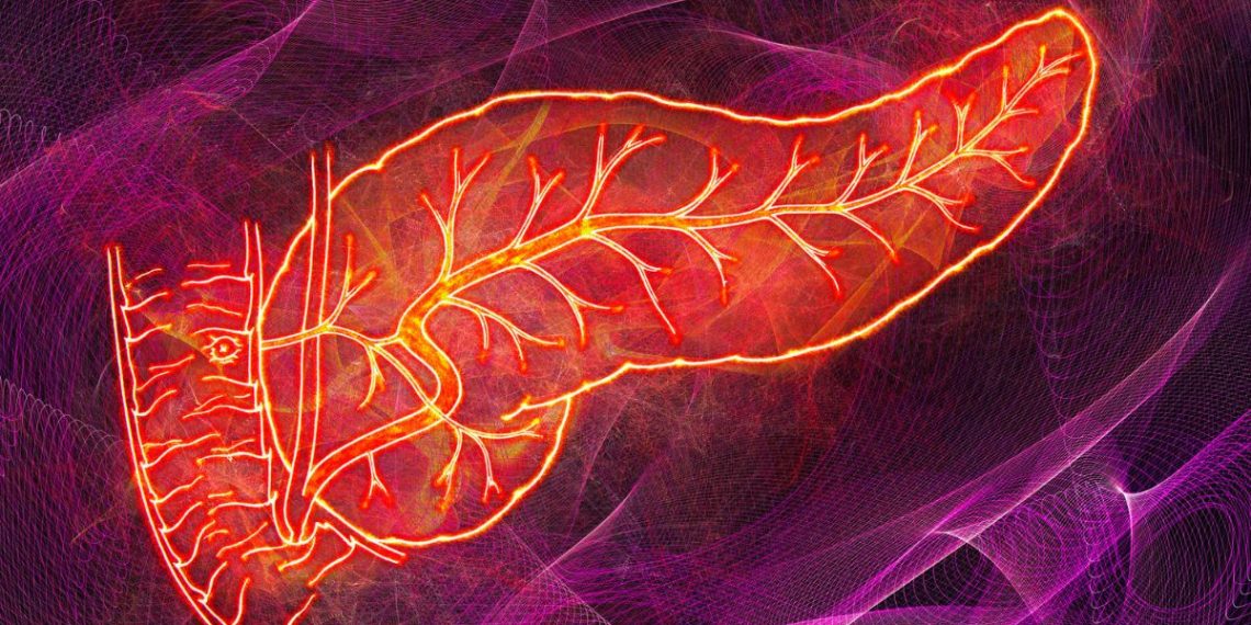 Understanding Idiopathic Pancreatitis