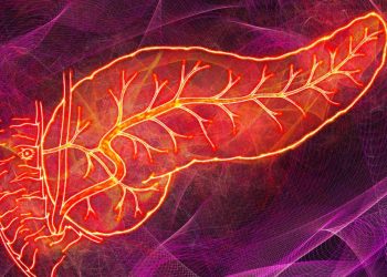 Understanding Idiopathic Pancreatitis