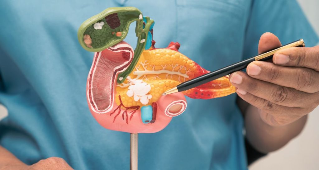 What Causes Acute Pancreatitis