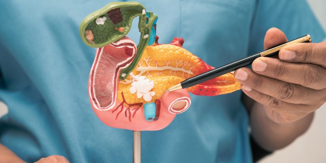 What Causes Acute Pancreatitis