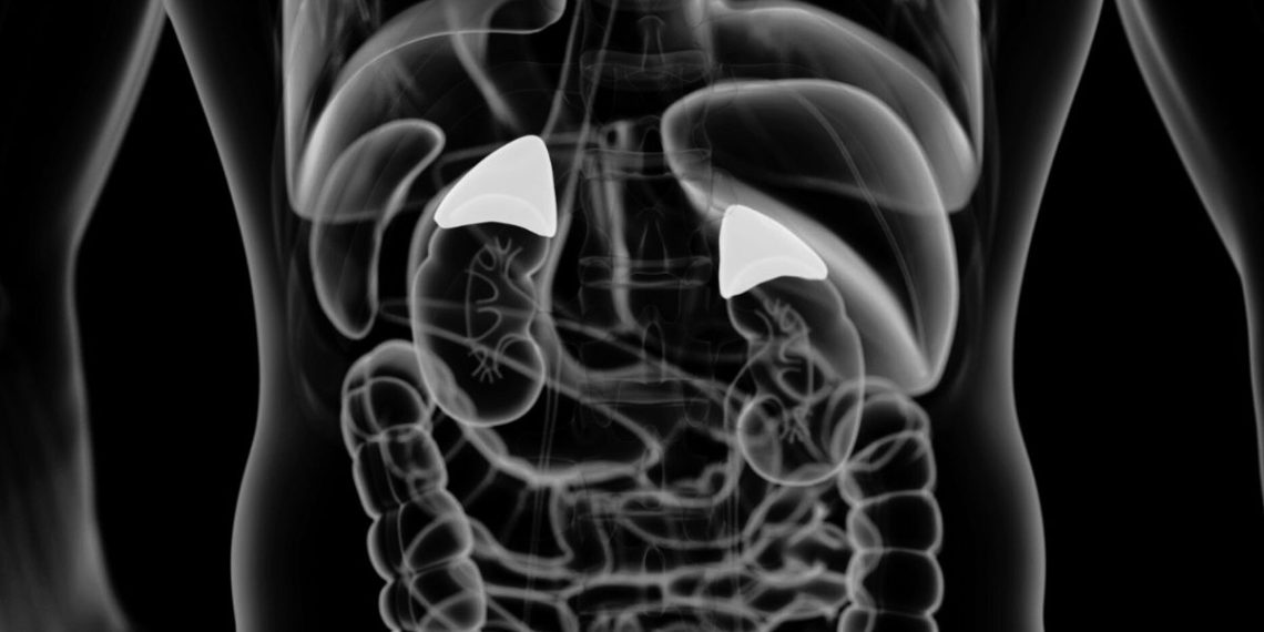 What Causes Addison’s Disease