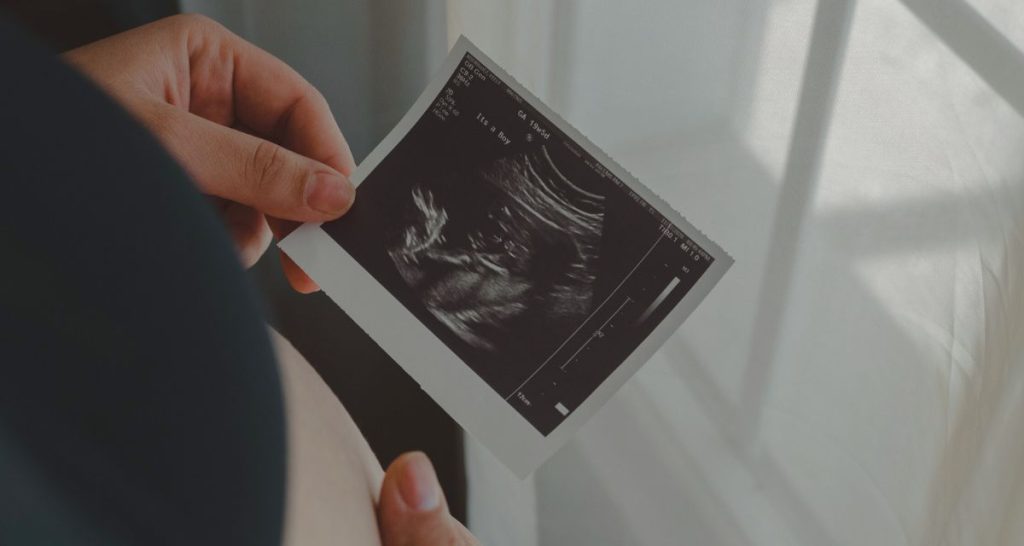 Hand holding an ultrasound image of a foetus