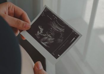 Hand holding an ultrasound image of a foetus