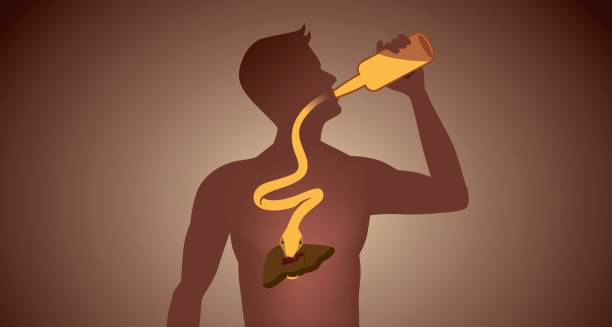 Illustration of alcohol damaging the liver, representing a common cause of cirrhosis.