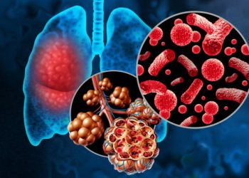 Illustration showing lung infection and virus particles linked to the common cold