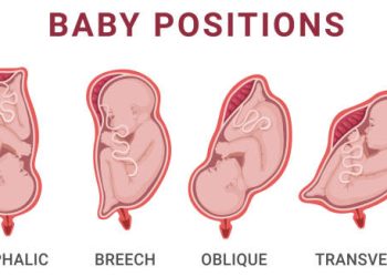 Illustration of various fetal positions in the womb, including cephalic, breech, oblique, and transverse, which may influence cranial development.