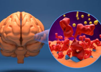 Causes of Creutzfeldt-Jakob Disease