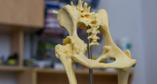 Anatomical model showing hip joint deformation