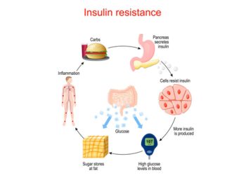 Cycle of insulin resistance and glucose build-up