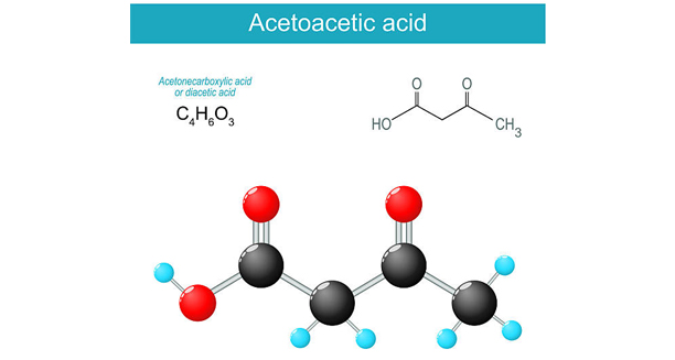 Blood sample labelled diabetic ketoacidosis held by gloved hand