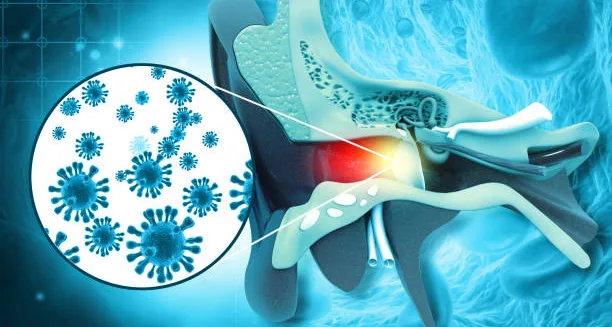 Medical illustration showing bacteria causing an ear infection