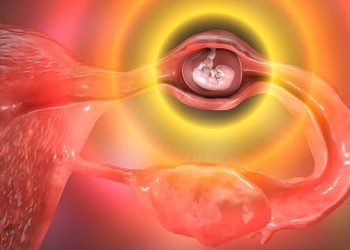 3D illustration of an ectopic pregnancy showing embryo implanted in the fallopian tube.