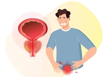 Illustration of man experiencing pelvic pain with an enlarged prostate diagram