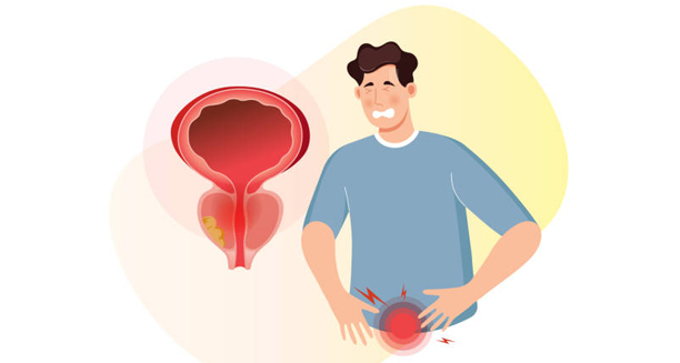 Illustration of man experiencing pelvic pain with an enlarged prostate diagram