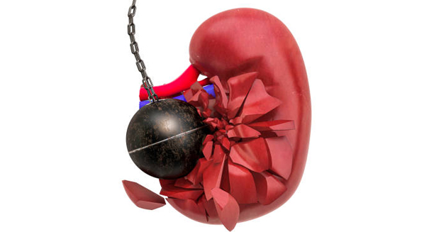 Kidney being struck by a wrecking ball symbolising chronic kidney disease damage