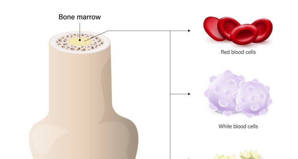 Bone marrow diagram showing red and white blood cells involved in chronic lymphocytic leukaemia