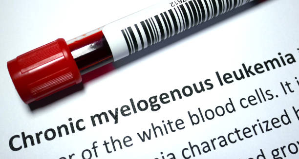 Yellow radiation warning flag symbolising environmental causes of chronic myeloid leukaemia.