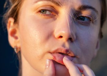 Woman touching her lip with visible cold sore
