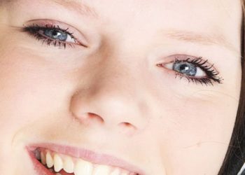 Close-up of a smiling child after cataract treatment with clear blue eyes