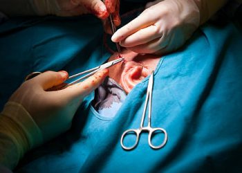 Surgical treatment of cholesteatoma being performed on a patient’s ear