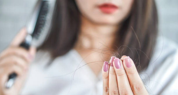 Woman noticing hair fall after brushing, linked to dandruff