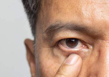 Close-up of eye after retinal surgery