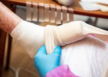 Medical professional wrapping a severely affected foot due to Epidermolysis Bullosa complications