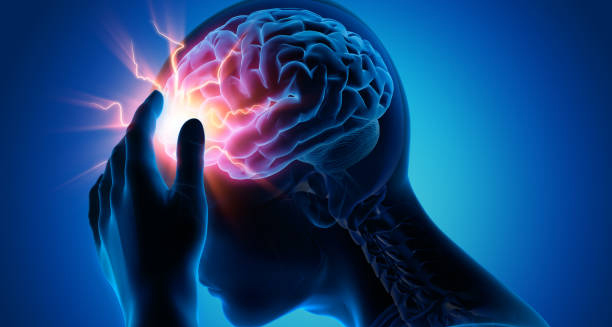 Digital illustration of a person holding their head in pain, highlighting brain trauma from concussion