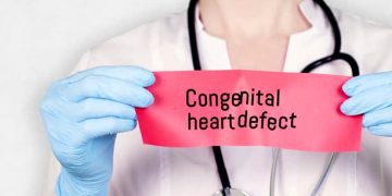 Doctor holding a red card labelled congenital heart defect