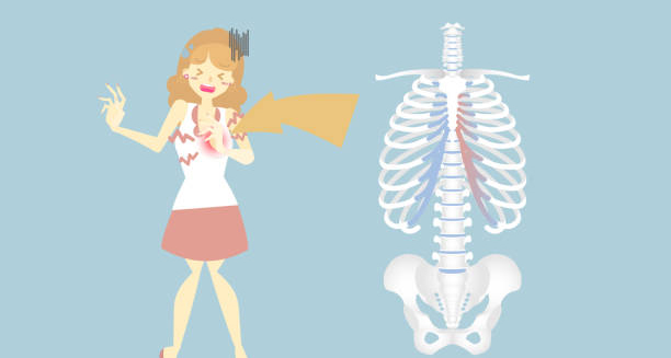 Illustration of a woman experiencing chest pain with a diagram of the ribcage highlighting costal cartilage inflammation, indicating costochondritis.
