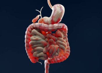 3D medical illustration of the human digestive system highlighting the intestines, representing inflammation linked to Crohn’s disease.