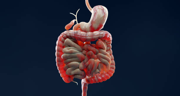 3D medical illustration of the human digestive system highlighting the intestines, representing inflammation linked to Crohn’s disease.