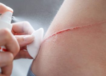 Close-up of a person cleaning a shallow cut on the skin using a cotton pad and antiseptic spray.