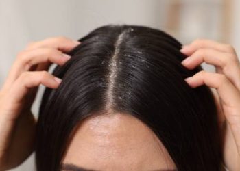 Close-up of a person parting their dark hair to reveal visible dandruff on the scalp