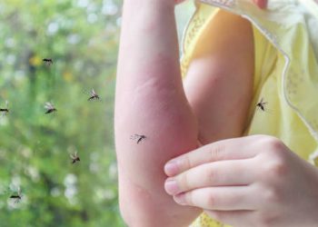 Child’s swollen arm from mosquito bites, indicating potential dengue exposure