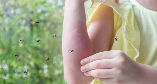Child’s swollen arm from mosquito bites, indicating potential dengue exposure