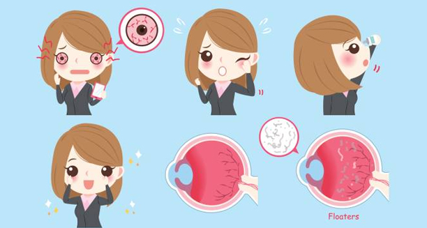 Cartoon illustration showing symptoms and treatment of a detached retina