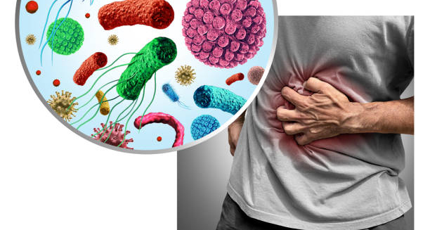 Illustration of Clostridium difficile bacteria causing abdominal pain in a patient