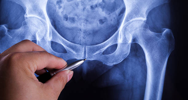 X-ray image highlighting coccyx with a pen for diagnosis