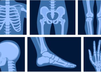 Illustrated X-rays of various body parts including skull, chest, pelvis, limbs, and hand