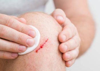 Person cleaning a bleeding cut on their knee with a cotton pad.