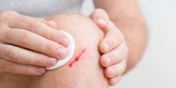 Person cleaning a bleeding cut on their knee with a cotton pad.