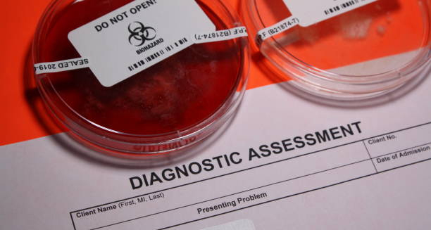 Laboratory diagnostic assessment form alongside sealed biohazard petri dishes, indicating medical testing in progress.